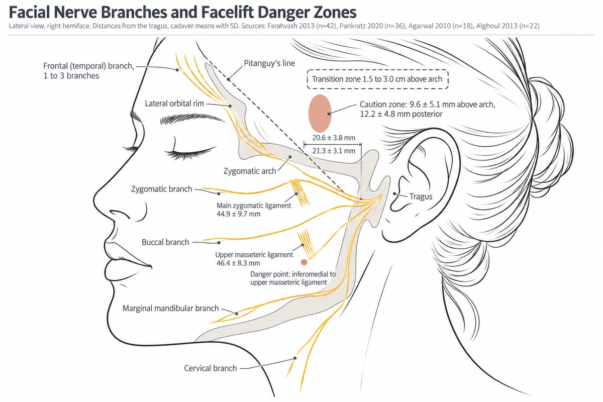 Facial nerve branches and facelift danger zones, a lateral view of a right hemiface mapping the five branch groups fanning from the parotid region: the frontal branch as one to three separate branches crossing the zygomatic arch 20.6 plus or minus 3.8 mm from the tragus, the zygomatic, buccal, marginal mandibular and cervical branches across the cheek, jaw and upper neck, a terracotta caution zone 9.6 plus or minus 5.1 mm above the arch, a separate dashed transition band 1.5 to 3.0 cm above it, and gold marks for the main zygomatic and upper masseteric ligaments with the danger point immediately inferomedial to the latter.