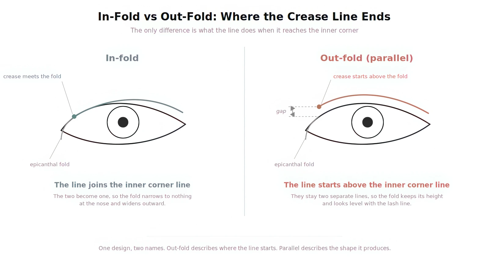 Rancangan lipatan kelopak mata ganda in-fold dibandingkan out-fold: pada in-fold garis lipatan bertemu lipatan epikantus di sudut dalam dan keduanya berlanjut sebagai satu garis, sedangkan pada out-fold garis lipatan bermula di atas lipatan epikantus dan tetap terpisah, menyisakan celah dan lipatan dengan tinggi merata.