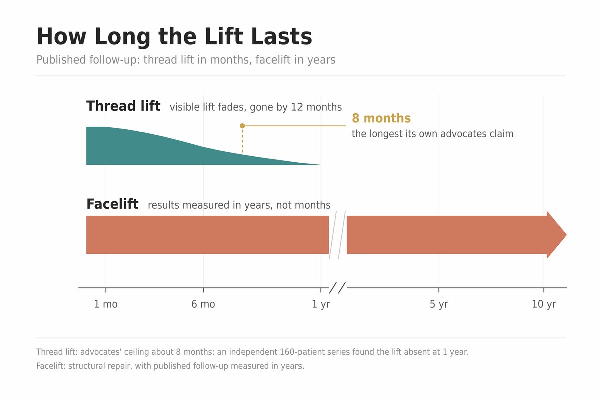 Timeline chart comparing how long lifting procedures last: a thread lift bar that peaks in the first month, fades through month six, and ends by month twelve, an eight-month marker labeling the duration its own advocates claim, and a facelift bar continuing steadily across a ten-year axis.