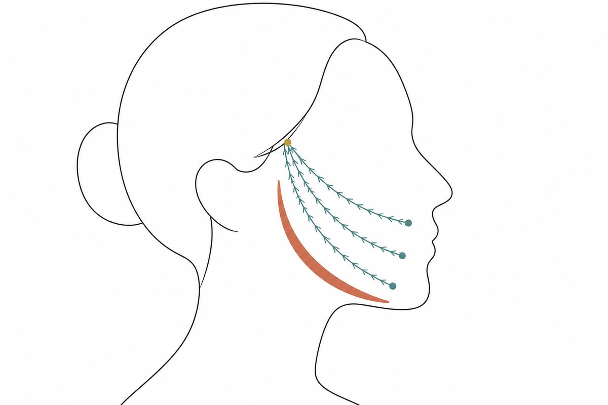 Thread Lift vs. Facelift: What a Barbed Thread Can Hold, and for How Long