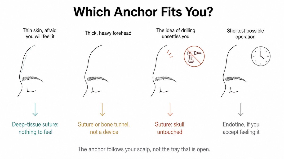 Decision chart matching forehead-lift fixation to the patient: thin skin or fear of feeling a device to deep-tissue suture, a thick heavy forehead to suture or bone tunnel, discomfort with skull drilling to suture, and a need for the fastest operation to Endotine.